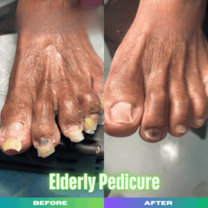TapLook Senior Nail Care, Because Clean Hands and Feet Matter at Every Age 2 Untitled design 7