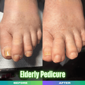TapLook Senior Nail Care, Because Clean Hands and Feet Matter at Every Age 3 Untitled design 8